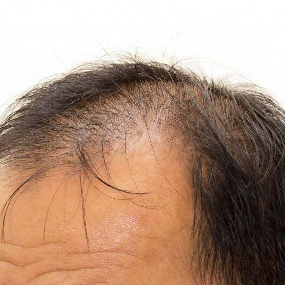 Har du fått måne eller viker? - Cancam