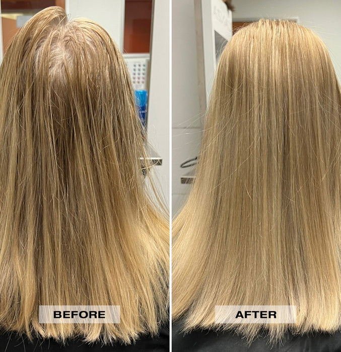 Lanza Dry Shampoo 300ml - Cancam