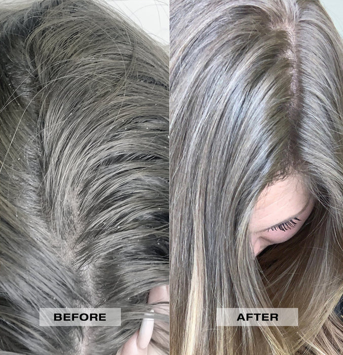 Lanza Remedy Conditioner 250ml - Cancam