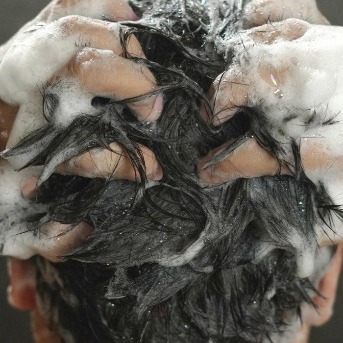 BLI KVITT FLASS OG KLØENDE HODEBUNN - Cancam