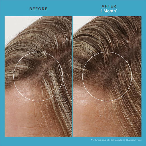 Living Proof Scalp Care Revitalizing Treatment 73 ml - Cancam